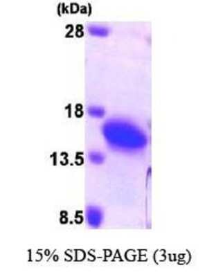 SDS-PAGE: Recombinant Human Profilin 2 His Protein [NBP1-44493]