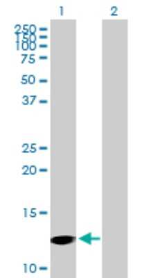 Western Blot: Profilin 4 Antibody [H00375189-B01P]