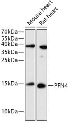 Western Blot: Profilin 4 AntibodyAzide and BSA Free [NBP2-94616]