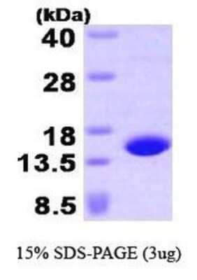 SDS-PAGE: Recombinant Human Profilin 4 His Protein [NBP1-41134]