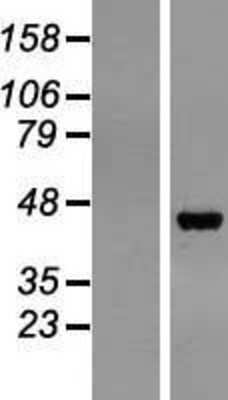 Western Blot: Pepsinogen C/PGC/Progastricsin Overexpression Lysate [NBL1-14327]