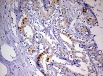 Immunohistochemistry: Progesterone R/NR3C3 Antibody (OTI11E8) [NBP2-46388]