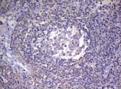 Immunohistochemistry: Progesterone R/NR3C3 Antibody (OTI11E8) [NBP2-46388]