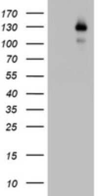 Western Blot: Progesterone R/NR3C3 Antibody (OTI11E8) [NBP2-46388]