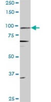 Western Blot: Progesterone R/NR3C3 Antibody (4E9) [H00005241-M08]