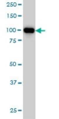 Western Blot: Progesterone R/NR3C3 Antibody (4E9) [H00005241-M08]