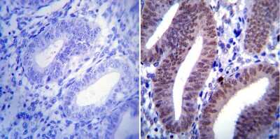 Immunohistochemistry-Paraffin: Progesterone R/NR3C3 Antibody (Alpha PR6) - BSA Free [NB120-2765]