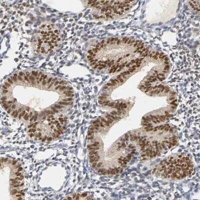 Immunohistochemistry-Paraffin: Progesterone R/NR3C3 Antibody [NBP1-87774]