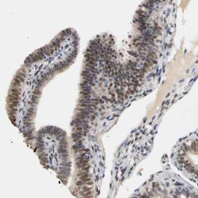 Immunohistochemistry-Paraffin: Progesterone R/NR3C3 Antibody [NBP1-87774]
