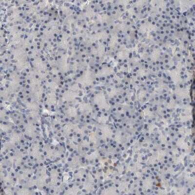 Immunohistochemistry-Paraffin: Progesterone R/NR3C3 Antibody [NBP1-87774]