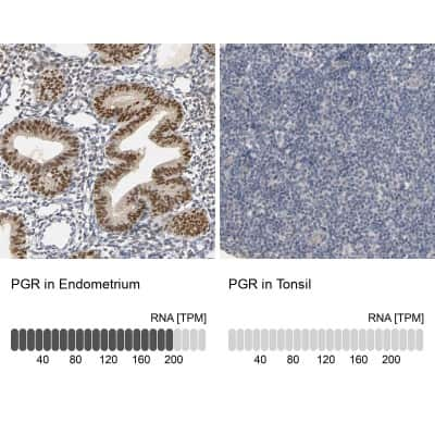 Immunohistochemistry-Paraffin: Progesterone R/NR3C3 Antibody [NBP1-87774]