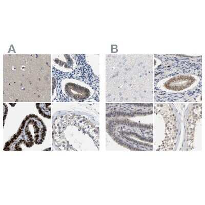 Immunohistochemistry-Paraffin: Progesterone R/NR3C3 Antibody [NBP1-87775]