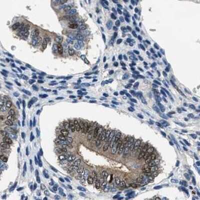 Immunohistochemistry-Paraffin: Progesterone R/NR3C3 Antibody [NBP1-87775]