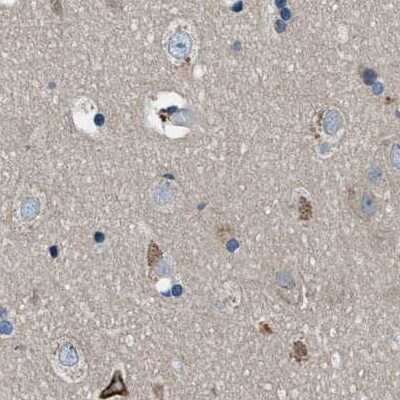 Immunohistochemistry-Paraffin: Progesterone R/NR3C3 Antibody [NBP1-87775]