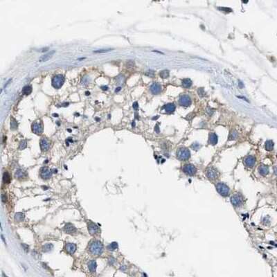 Immunohistochemistry-Paraffin: Progesterone R/NR3C3 Antibody [NBP1-87775]