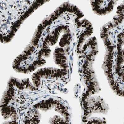 Immunohistochemistry-Paraffin: Progesterone R/NR3C3 Antibody [NBP1-87776]