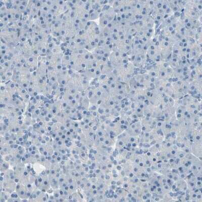 Immunohistochemistry-Paraffin: Progesterone R/NR3C3 Antibody [NBP1-87776]