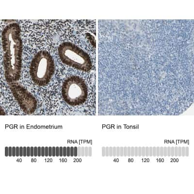 Immunohistochemistry-Paraffin: Progesterone R/NR3C3 Antibody [NBP1-87776]