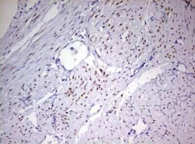 Immunohistochemistry: Progesterone R/NR3C3 Antibody (OTI11E8) - Azide and BSA Free [NBP2-73607]