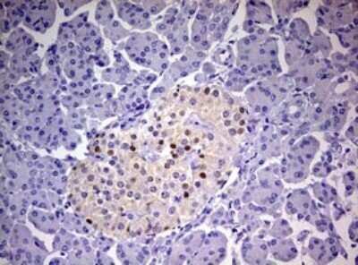 Immunohistochemistry: Progesterone R/NR3C3 Antibody (OTI11E8) - Azide and BSA Free [NBP2-73607]