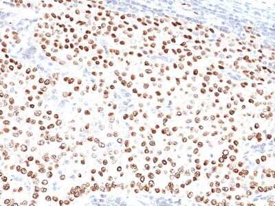 Immunohistochemistry-Paraffin: Progesterone R/NR3C3 Antibody (PR484) - Azide and BSA Free [NBP2-33325]