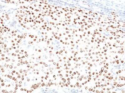 Immunohistochemistry-Paraffin: Progesterone R/NR3C3 Antibody (PR500) - Azide and BSA Free [NBP2-33327]