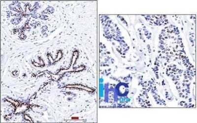 Immunohistochemistry-Paraffin: Progesterone R/NR3C3 Antibody (PR501) - Azide and BSA Free [NBP2-33369]