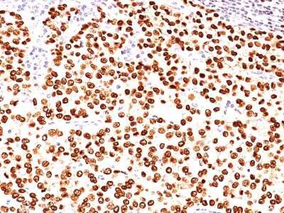 Immunohistochemistry-Paraffin: Progesterone R/NR3C3 Antibody (SPM566) - Azide and BSA Free [NBP2-34429]