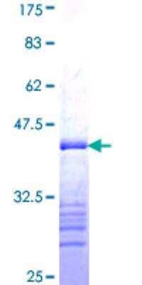 SDS-PAGE: Recombinant Human Progesterone R/NR3C3 GST (N-Term) Protein [H00005241-Q01]