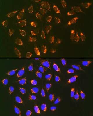 Immunocytochemistry/ Immunofluorescence: Prohibitin 2 Antibody (8I10B1) [NBP3-16766]