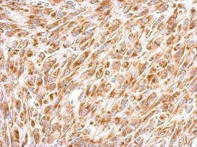 Immunohistochemistry-Paraffin: Prohibitin 2 Antibody [NBP1-33463]