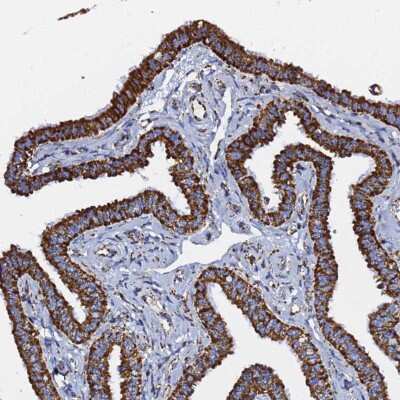 Immunohistochemistry-Paraffin: Prohibitin 2 Antibody [NBP2-13754]