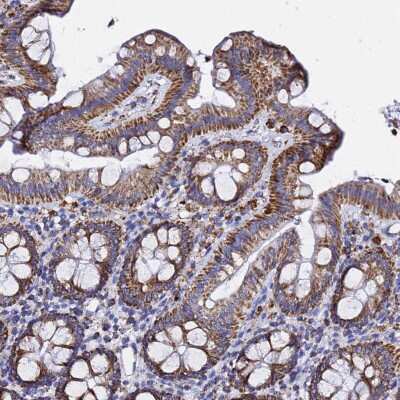 Immunohistochemistry-Paraffin: Prohibitin 2 Antibody [NBP2-13754]