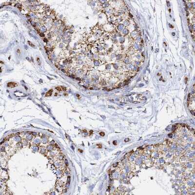 Immunohistochemistry-Paraffin: Prohibitin 2 Antibody [NBP2-13754]