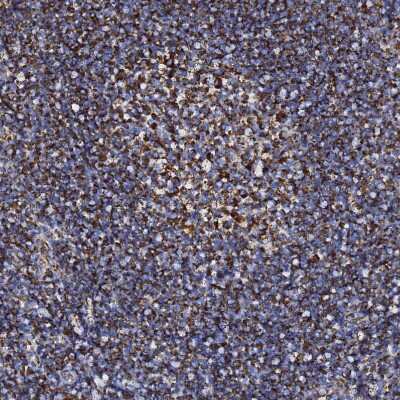 Immunohistochemistry-Paraffin: Prohibitin 2 Antibody [NBP2-13754]