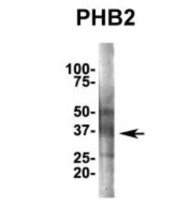 Immunoprecipitation: Prohibitin 2 Antibody [NBP1-98312]