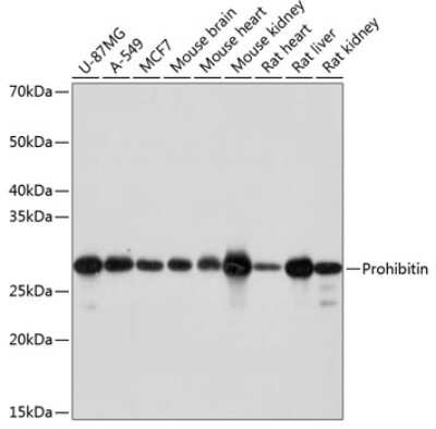 Western Blot: Prohibitin Antibody (0V2R10) [NBP3-15756]