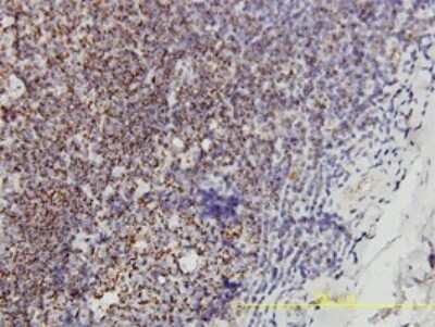 Immunohistochemistry-Paraffin: Prohibitin Antibody (3F4-2B2) [H00005245-M01]