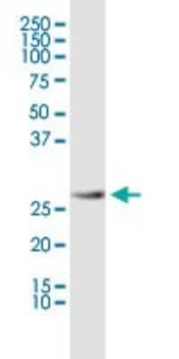 Western Blot: Prohibitin Antibody (3F4-2B2) [H00005245-M01]