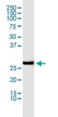 Western Blot: Prohibitin Antibody (3F4-2B2) [H00005245-M01]