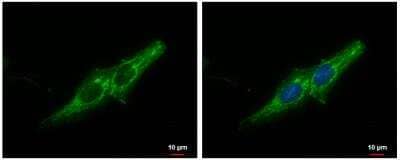 Immunocytochemistry/ Immunofluorescence: Prohibitin Antibody [NBP2-19944]