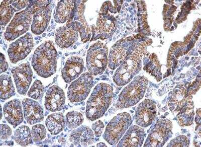 Immunohistochemistry-Paraffin: Prohibitin Antibody [NBP2-19944]