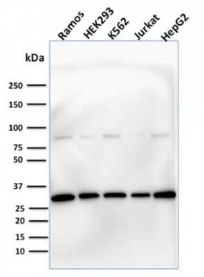 Western Blot: Prohibitin Antibody (PHB/1881) [NBP3-07816]