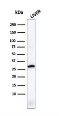 Western Blot: Prohibitin Antibody (PHB/1881) [NBP3-07816]