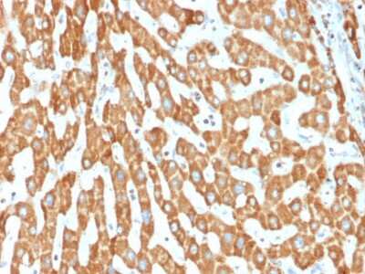 Immunohistochemistry-Paraffin: Prohibitin Antibody (PHB/1882) [NBP3-07833]