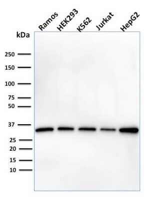 Western Blot: Prohibitin Antibody (PHB/1882) [NBP3-07833]