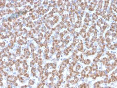 Immunohistochemistry-Paraffin: Prohibitin Antibody (PHB/3193) [NBP3-07834]