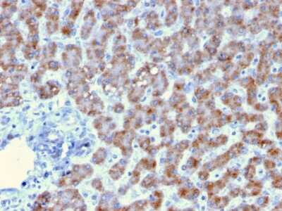 Immunohistochemistry-Paraffin: Prohibitin Antibody (PHB/3193) [NBP3-07834]