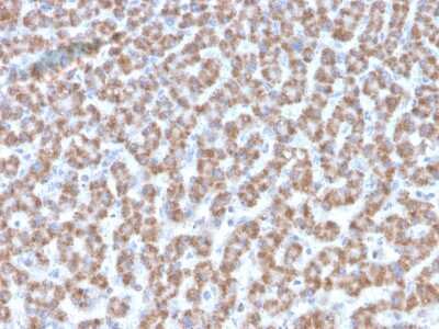 Immunohistochemistry-Paraffin: Prohibitin Antibody (PHB/3193) - Azide and BSA Free [NBP3-08724]