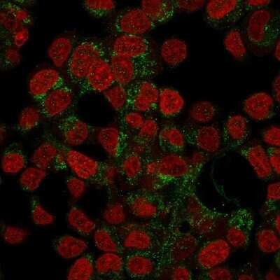 Immunocytochemistry/ Immunofluorescence: Prohibitin Antibody (PHB/3194) [NBP3-07841]